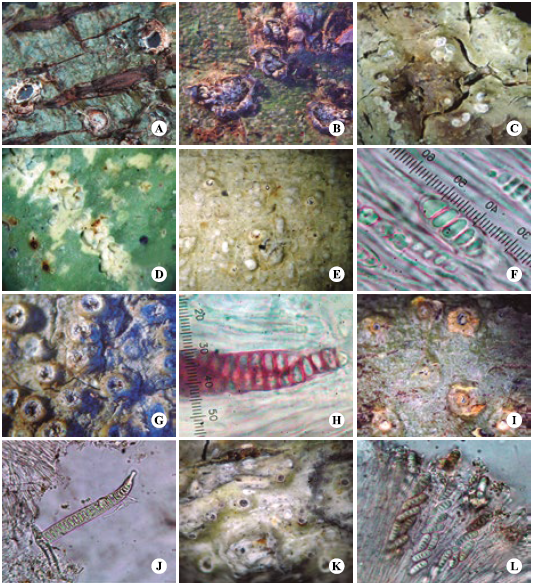 Talos y ascosporas de espec&iacute;menes de la familia Graphidaceae A) Chapsa sublilacina var. cyanea. B) Gyrotrema &aacute;lbum. C) esquizidios de Myriotrema frondosolucens. D) esquizidios de M. neofrondosum. E) Ocellularia albobullata. F) O. albobullata. G) apotecios de O. crocea. H) ascosporas de O. crocea. I) apotecios con medula amarilla naranja de O. fecunda. J) ascosporas de O. fecunda. K) apotecios de O. inspersula. L) ascosporas de O. inspersula.