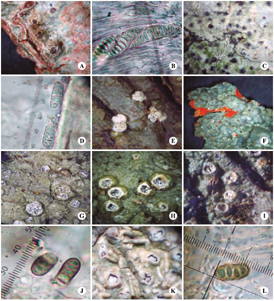 Talos y ascosporas de A) apotecios de Ocellularia pluriporoides. B) ascosporas de O. pluriporoides. C) apotecios de O. subpyrenuloides. D) ascosporas de O. subpyrenuloides. E) soralios de O. vulcanisorediata. F) talo con m&eacute;dula naranja de O. xanthostroma. G) apotecios de Stegobolus anamorphoides. H) apotecios de Rhabdodiscus auberianus. I) apotecios de R. lankaensis. J) ascosporas de R. integer. K) apotecios de R. isidiifer. L) ascosporas de R. isidiifer.