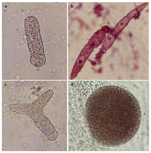 Distintas fases vitales de gregarinas intestinales de Farfantepenaeus brasiliensis: gamonte solitario (a); sicigias de cadena recta (biasociaci&oacute;n y triasociaci&oacute;n), te&ntilde;idas con orce&iacute;na ac&eacute;tica (b); sicigia ramificada (c); y gametoquiste tard&iacute;o (d).