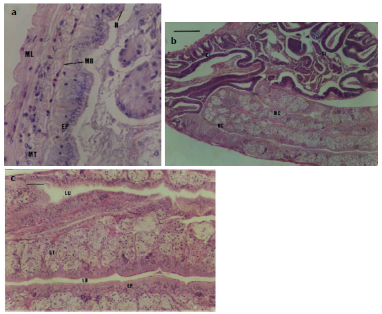 Secciones histol&oacute;gicas de tracto intestinal de Farfantepenaeus brasiliensis: (a) Intestino medio mostrando reborde [R], epitelio [EP], membrana basal [MB], capas musculares transversal [MT] y longitudinal [ML]; (b) conjunci&oacute;n de ciego intestinal [CI] y recto [RC]; y (c) detalle del recto, not&aacute;ndose el lumen [LU], epitelio [EP] y gl&aacute;ndulas de tegumento [GT].
