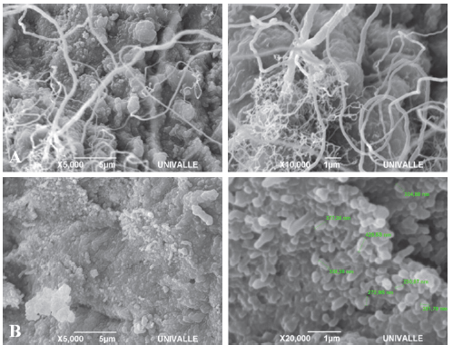 Dentin (A) and enamel (B) samples of teeth subjected to 200&deg;C.
