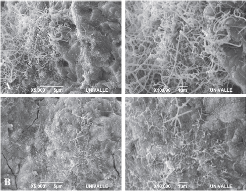 Dentin (A) and enamel (B) samples of teeth subjected to 400&deg;C. 