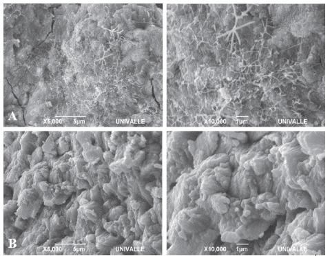 Dentin (A) and enamel (B) samples of teeth subjected to 600&deg;C.