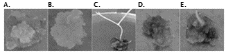 Formación de callos en diferentes tipos de explantes y concentraciones hormonales de 2,4-D. Nudo + 2.5 mg L-1 2,4-D (A). Entrenudo + 2.0 mg L-1 2,4-D (B). Nudo + 3.5mg L-1 2,4-D (C). Hoja + 3.5 mg L-1 2,4-D (D). Hoja + 2.0 mg L-1 2,4-D (E). Todos los explantes se cultivaron en medio MS durante 24 días.