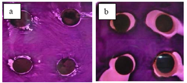 Apariencia de las zonas de inhibición en placas de agar EMB. Se muestra la actividad antimicrobiana contra la bacteria Gram negativa E. coli. Películas de a) carragenina y b) carragenina y AgNPs.