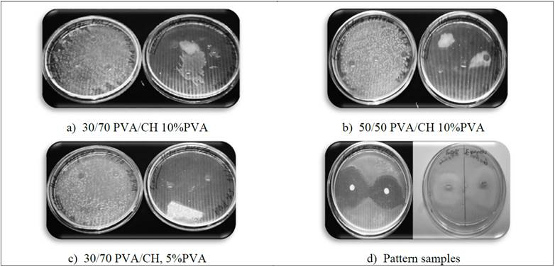 Inoculation of PVA/CH discs in bacterial cultures: Left: E. Coli, right: S. Aureus