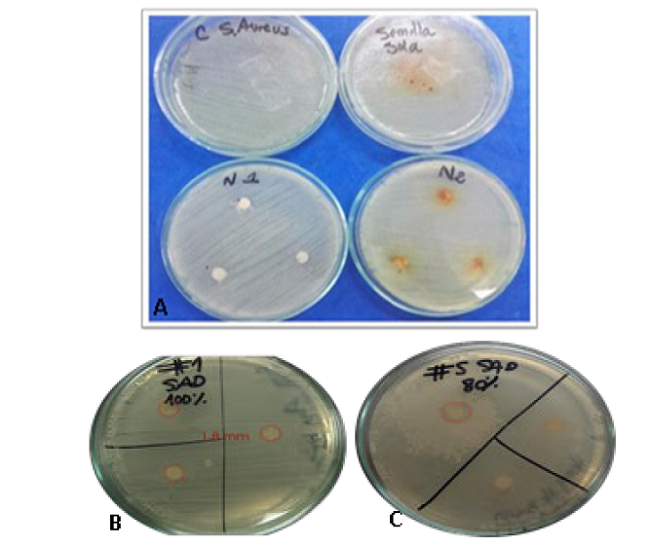 Growth of the Staphylococcus aureus strain. A) Hot extract; B) Extract with solvents; C) 80% extract contaminated with another microorganism; D) MIC test.