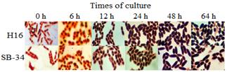 Intracellular accumulation of PHAs granules in SB-34 and R. eutropha H16 over time. The presence of the polymer was evaluated by staining with Sudan B black at time intervals for 64 hours. The internal areas stained black correspond to presumptive PHAs granules.