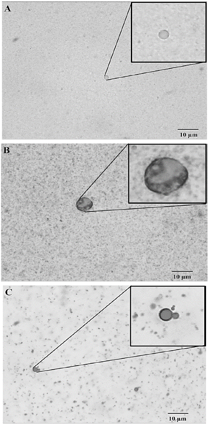 Microscopy for micelle observation during the stability analysis of astaxanthin oleoresin emulsion, with 100x magnification. A) day 0, sample without dilution; B) day 8; sample without dilution; C) day 7, sample with dilution in 1000 µL of water.