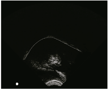 Example: Tongue contour from a 2D ultrasound image.