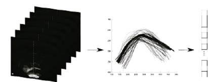 Diagram representing articulatory information (ultrasound images).