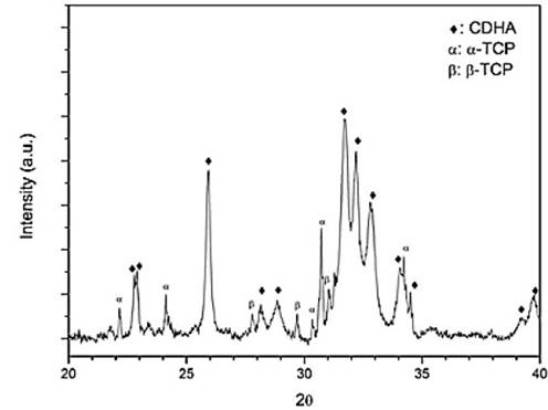 XRD spectra of C4 after setting for 7 days in Ringer&rsquo;s solution (Reference:α-TCP JCPDS 9-348, β-TCP JCPDS 9-169, CDHA JCPDS 9-432).