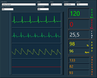 Biomedical signals on the central monitoring station.