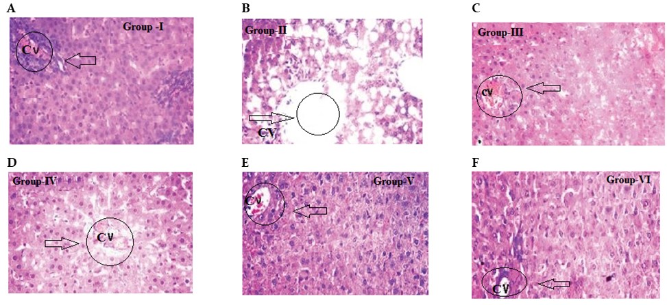 Histopathological injury induced by antitubercular drugs and the protection of N. arbor-tristi leaf ethanolic extract and silymarin orally administered.