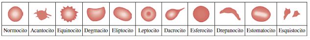 Tipos de Eritrocitos [12].