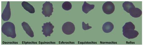 Algunos tipos de eritrocitos en nuestra base de datos.