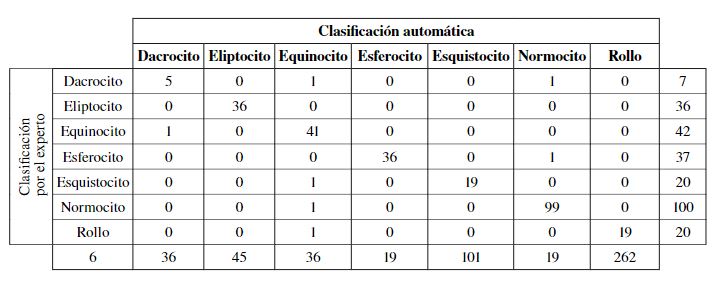 Resultados del Clasificador con el conjunto completo de 262 células en la base de datos
