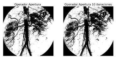 Operador apertura difuso con relaci&oacute;n estructural reflexiva.