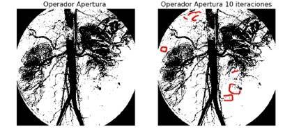 Operador apertura difuso con relaci&oacute;n estructural no reflexiva ni *-antitransitiva.