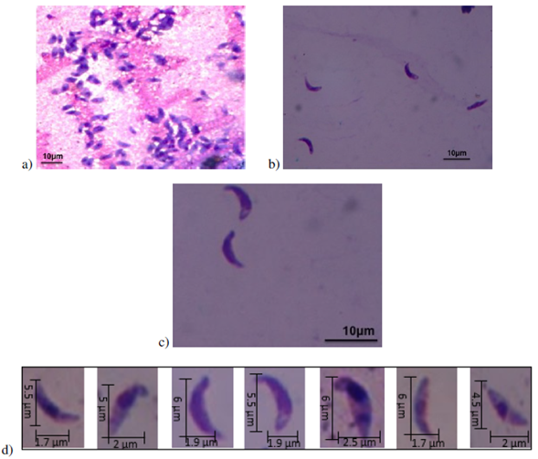 Stained T. gondii images with Giemsa. a) Maximum tachyzoite concentration b) 1,5 dilution factor of the tachyzoites c) Tachyzoite morphology d) Size of different tachyzoites