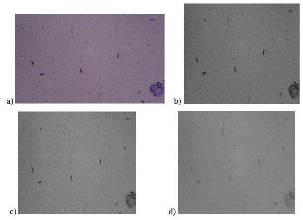 Channel comparison. a) RGB image. b) channel G. c) channel R. d) channel B.