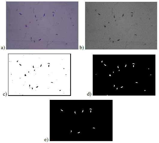 Image processing results: a) original image, b) channel G, c) threshold result, d) applying morphological filter, e) classified tachyzoites
