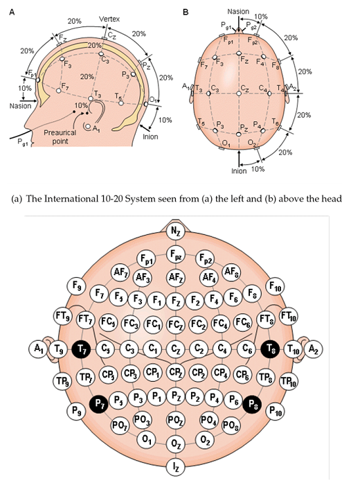 Location of electrodes according to the International 10-20 System 25