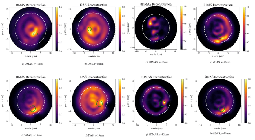 DMAS (a,e), DAS (b,f), itDMAS (c,g), and itDAS (d,h) reconstructed images (https://bit. ly/UM-bmid)