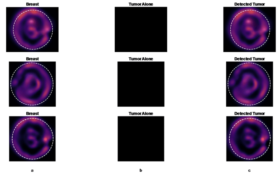 a) Source BMI; b) no tumor; c) no tumor identified