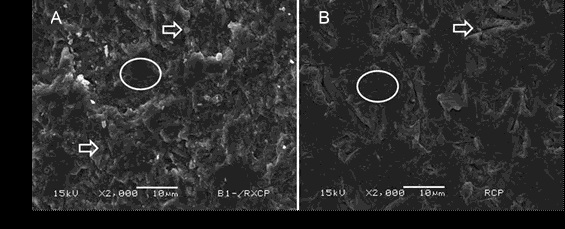(A) Representative image exhibiting the more prevalent failure pattern from group RCP-24h on ceramics´ surface (2000x), showing a cohesive failure in resin cement, where some resin cement particles (arrows) can be seen attached to the ceramic surface, also some clean ceramic areas can be noted (circle). (B) Representative image exhibiting the more prevalent failure pattern from group RCP6mo on ceramics´ surface (2000x), showing a clean ceramic surface (circle) with some irregularities (arrows), pointing that an adhesive failure between ceramic and cement occurred.