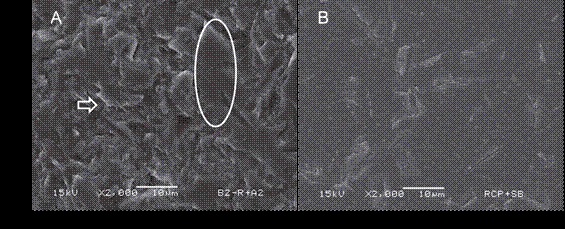 (A) Representative image exhibiting the more prevalent failure pattern from group RCP+SB-24h on ceramics´ surface (2000x), showing a mostly cohesive failure in adhesive system, where some flat adhesive areas can be noted along with some depressions forming an irregular pattern in which the adhesive layer fractured. (B) Representative image exhibiting the more prevalent failure pattern from group RCP+SB-6mo on ceramics´ surface (2000x), showing a clean ceramic surface, typical sign of an adhesive failure.
