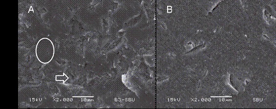 (A) Representative image exhibiting the more prevalent failure pattern from group SBU-24h on ceramics´ surface (2000x), showing a mostly cohesive failure in adhesive system, where some flat adhesive areas can be noted along with some depressions forming an irregular pattern in which the adhesive layer fractured, a similar pattern as on Fig.5A. (B) Representative image exhibiting the more prevalent failure pattern from group SBU-6mo on ceramics´ surface (2000x), showing a clean ceramic surface, typical sign of an adhesive failure, as shown on Fig.5B.