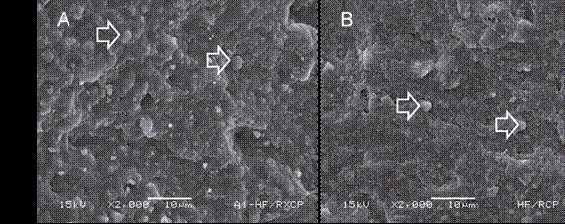 (A) Representative image exhibiting the more prevalent failure pattern from group PC-24h on ceramics´ surface (2000x), showing a cohesive failure in resin cement, where a complete resin cement layer with some particles embedded (arrows) can be seen. (B) Representative image exhibiting the more prevalent failure pattern from group PC-6mo on ceramics´ surface (2000x), showing also a cohesive failure on resin cement, but less profuse as on Fig.9A, probably consequence of resin cement leaching after aging. 