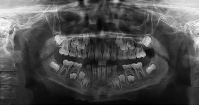 The pre-op panoramic view.