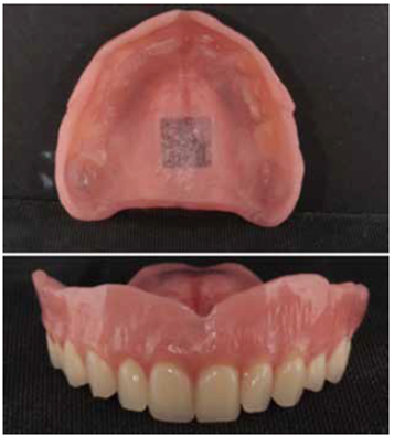 Finished dentures