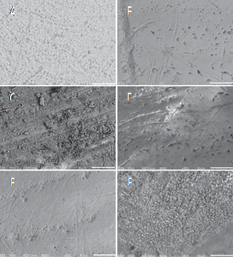 a) Pretreatment enamel surface morphology, b) Enamel surface after an artificial demineralization process, c) Enamel surface after treatment with xylitol toothpaste, d) Enamel surface after Camellia sinensis.