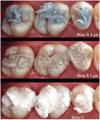 Secuencia de pulido. Arriba, primera aplicación de pasta diamantada de 3 micrones Shiny A. En el medio, pasta diamantada de 1 micrón Shiny B. Ambas pastas deben ser aplicadas con un fieltro de pelo de cabra. Entre cada pasta, una gasa con alcohol facilitará la limpieza de los excesos de pasta. Finalmente, abajo, pasta de óxido de aluminio Shiny C se debe aplicar con fieltro seco de algodón.