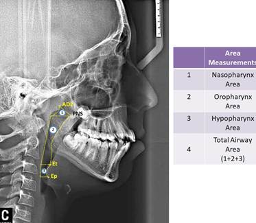 Area measurements used in study.