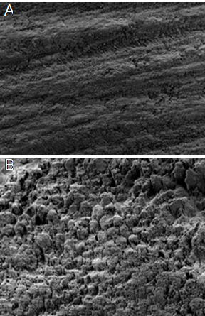 (A) Ground and etched enamel at 250x. (B) Ground and etched enamel at 1000x.