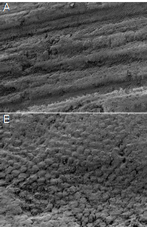 (A) Ground, etched and deproteinized enamel at 250x. (B) Ground, etched and deproteinized enamel at 1000x.