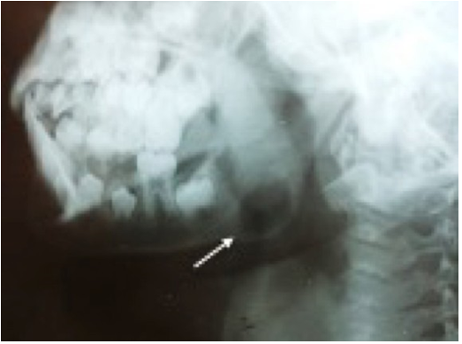 Left mandibular oblique radiograph. Well-defined ovoid radiolucent image is observed in the left mandibular angle.