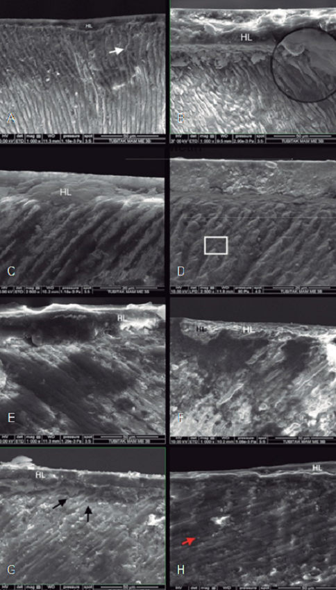 E-SEM micrographs of all tested groups at 1000x and 2500x magnification. A) non-irradiated enamel with ER mode, B) irradiated enamel with ER mode, C) non-irradiated enamel with SE mode, D) irradiated enamel with SE mode, E) non-irradiated dentin with ER mode, F) irradiated dentin with ER mode, G) non-irradiated dentin with SE mode, H) irradiated dentin with SE mode. HL: hybrid layer, black circle and black arrows: resin tags, white arrows: regular presence of prism, white square: loss of enamel prism, red arrow: obliterated dentinal tubules.