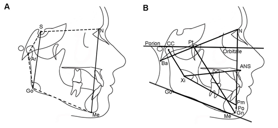 Cephalometric landmarks, planes, and angles for the Jarabak (A) and the Ricketts (B) analyses.