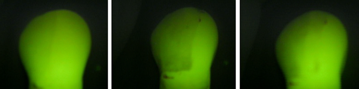 A. A healthy tooth, displaying the baseline mineral content and fluorescence; B. A tooth after the demineralization process, showing a significant reduction in mineral content and fluorescence intensity, evidenced by the appearance of a white spot; C. (GIII) A tooth after prophylaxis with a rubber cup and pumice stone, indicating the partial restoration of mineral content compared to the demineralized state.