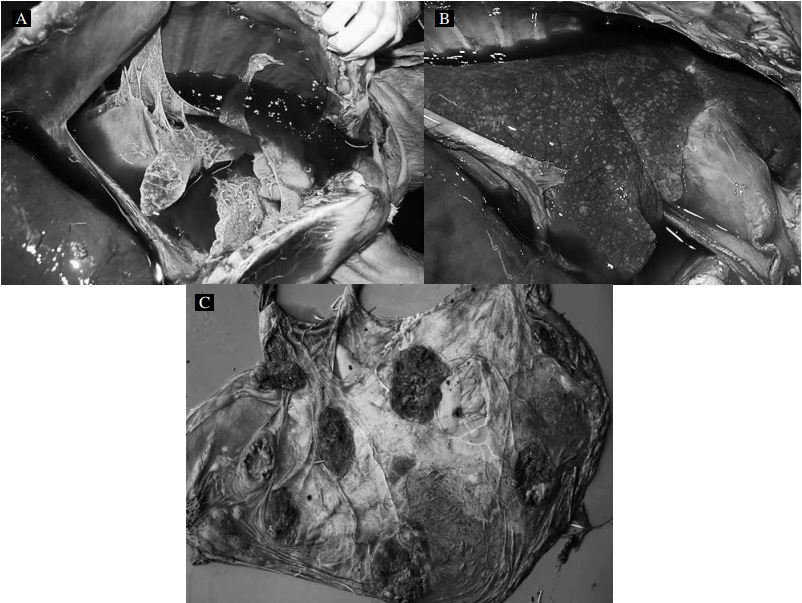 Aborted bovine fetuses infected with Brucella abortus. A. Intense fibrin
deposition on the pleural and pericardial surfaces, and purulent fluid in the
thoracic cavity. B. White spots in the lung parenchyma measuring between 0.1 mm
and 0.5 mm in diameter, and purulent fluid in the thoracic cavity. C. Placenta
exhibiting red areas in the intercotyledonary regions, and well-defined
yellowishwhite round areas on the cotyledonary surface.