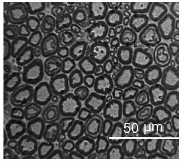 Micrograf&iacute;a
&oacute;ptica de un corte transversal (40x) del nervio oculomotor en el grupo E. Se
pueden observar las diferencias en el tama&ntilde;o de las fibras miel&iacute;nicas.