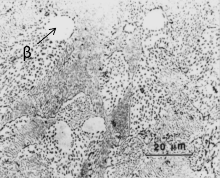 Micrograf&iacute;a &oacute;ptica de un recubrimiento
  de Zn-5%Al. [2]
