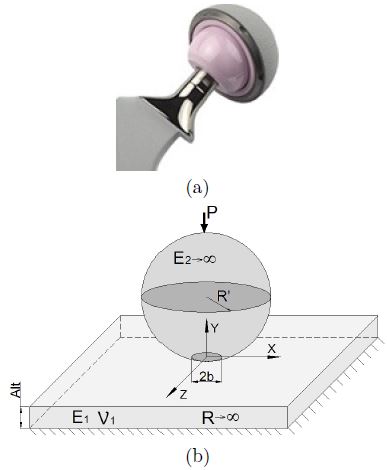 Figura 2. La geometr&iacute;a posee simetr&iacute;a polar. (a) Pr&oacute;tesistotal de cadera [18]. Se destacan en rosa la cabeza femoral yel acet&aacute;bulo. (b) Representaci&oacute;n equivalente en un contactoSoP.