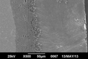 Micrograf&iacute;as por microscop&iacute;a electr&oacute;nica de barrido (MEB) de recubrimientos Zn-7Al, con diferentes condiciones de enfriamiento. A) agua. B) horno [6].