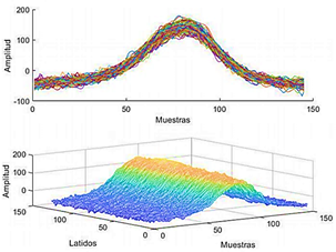 Figura 2. Segmentos ST-T alineados (128 segmentos) con una longitud de 132 muestras, de la se&ntilde;al TWADB55.